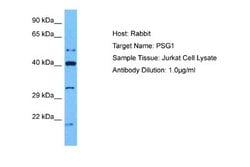PSG1 Rabbit anti-Human, Polyclonal, Novus Biologicals 0.1 mL | Buy Online | Novus Biologicals | Fisher Scientific